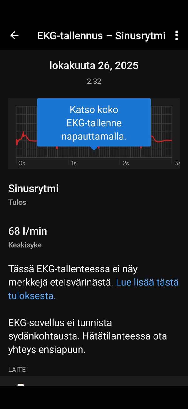 EKG