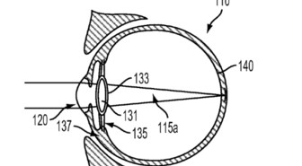 Google Glassin seuraava evoluution tuo Androidin silmän sisään?