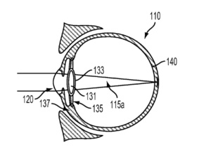 Google Glassin seuraava evoluution tuo Androidin silmän sisään?