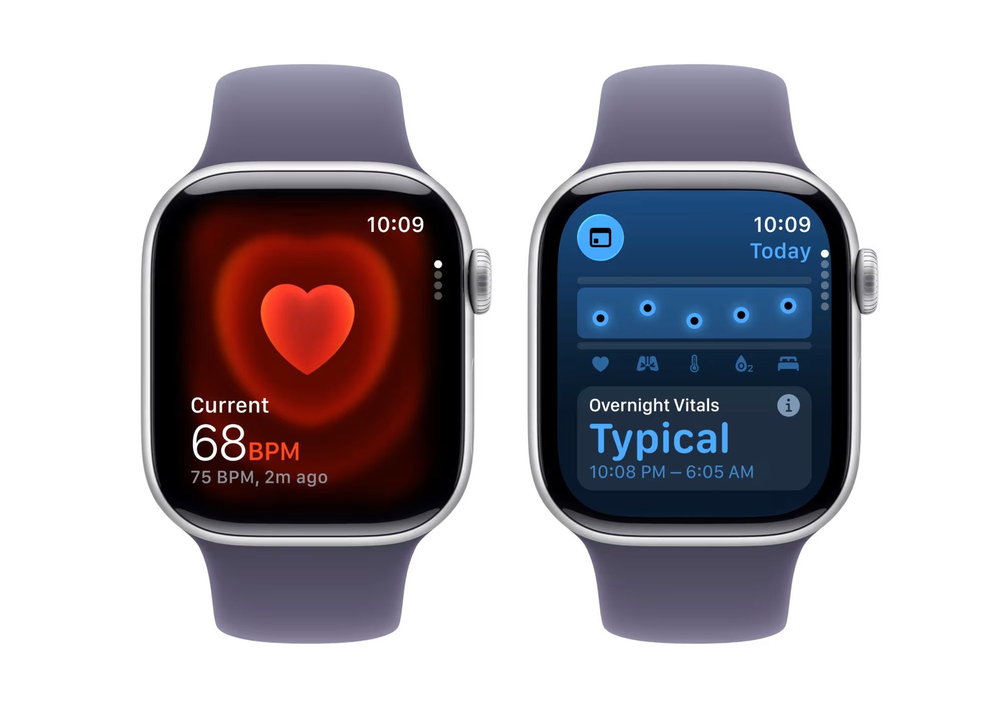 Päivän diili: Apple Watch 11 halvemmalla kuin kertaakaan